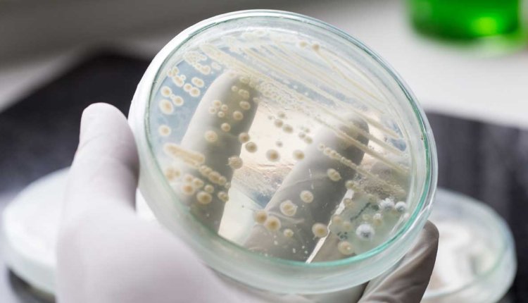 Schimmelinfectie