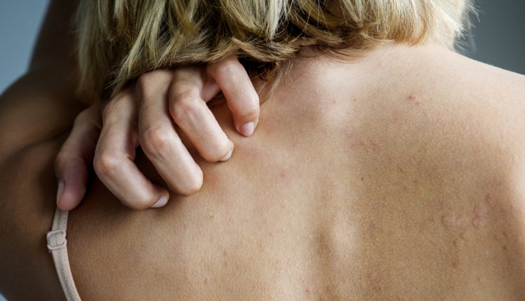 vrouw krabt op rug