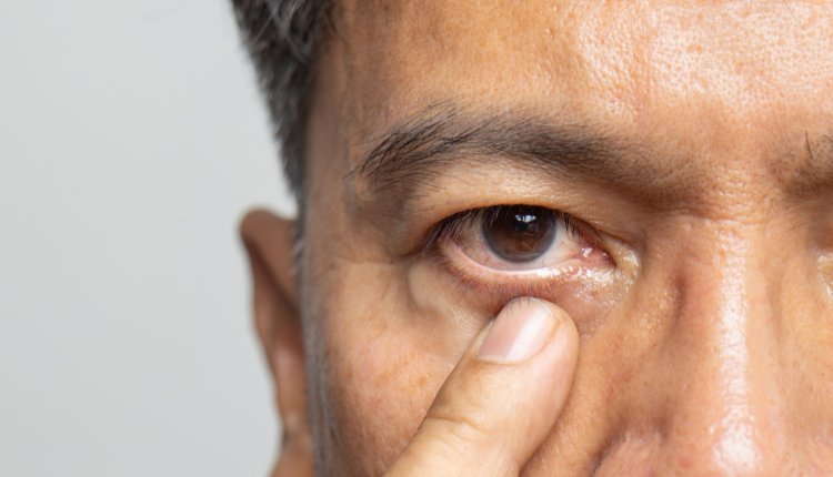 man heeft last van zijn oog
