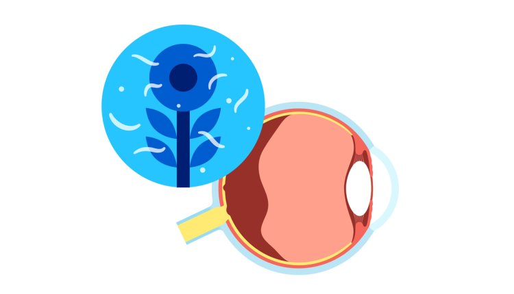 Tekening van hoe mouches volantes eruitziet