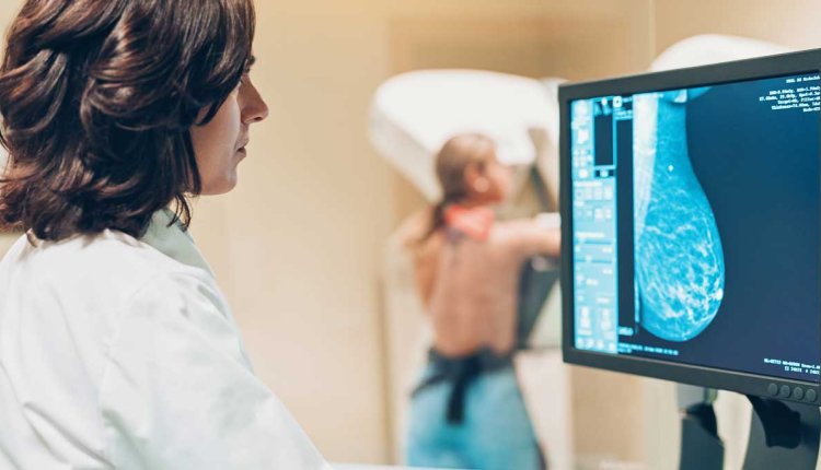 Mammografie