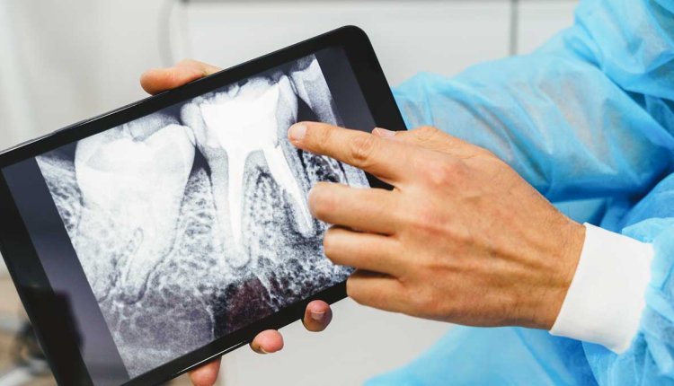 dentist met rontgenfoto