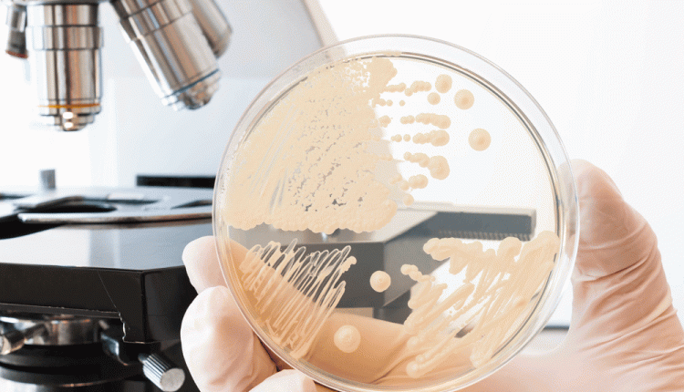 Candida
