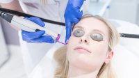 vrouw krijgt laserbehandeling
