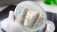 Schimmelinfectie