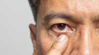 man heeft last van zijn oog
