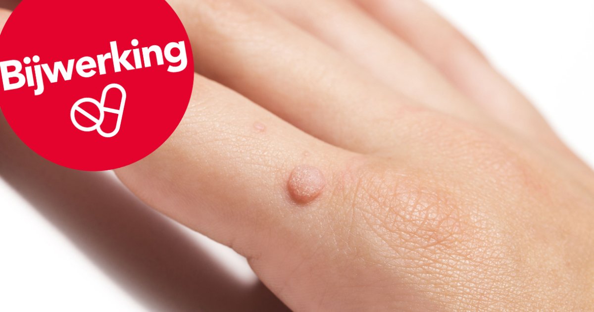 Wratten Labrador Last van wratten? Misschien komt het wel door je medicijn | PlusOnline