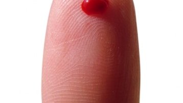 Te veel rode bloedcellen (erythrocytose)