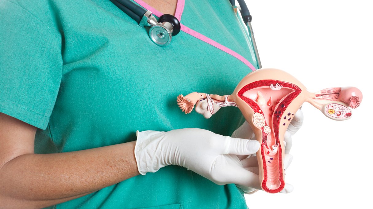 Wat is baarmoederkanker? | PlusOnline