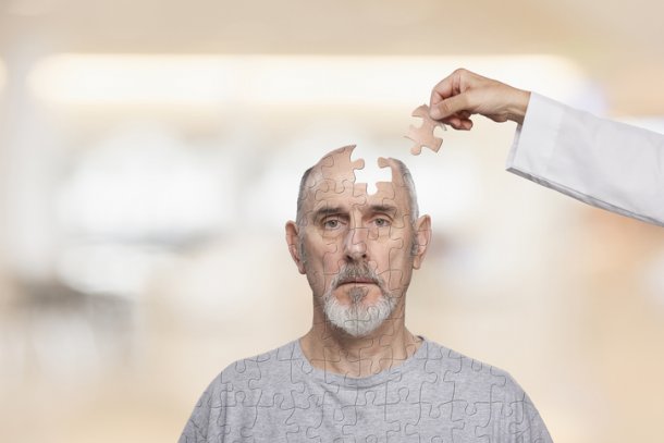 Man met hoofd waaruit een puzzelstukje is weggenomen, dat een hand met witte jas weer toevoegt. Senior.