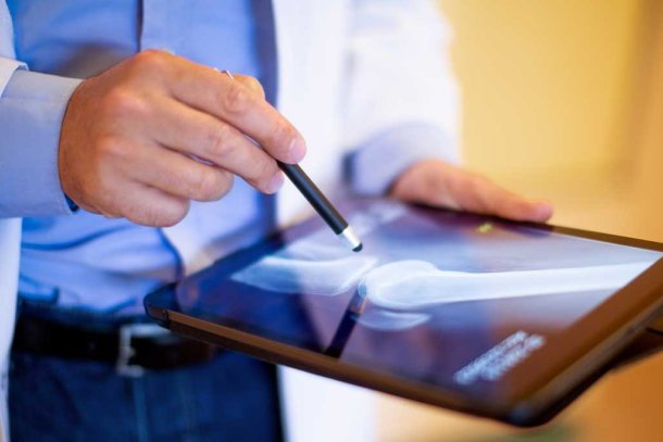 Dokter kijkt naar ipad met artrose foto