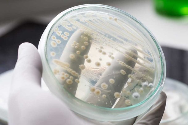 Schimmelinfectie