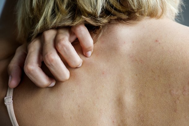 vrouw krabt op rug