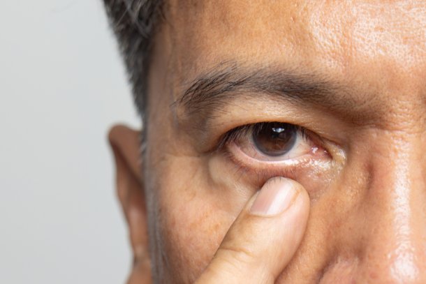 man heeft last van zijn oog