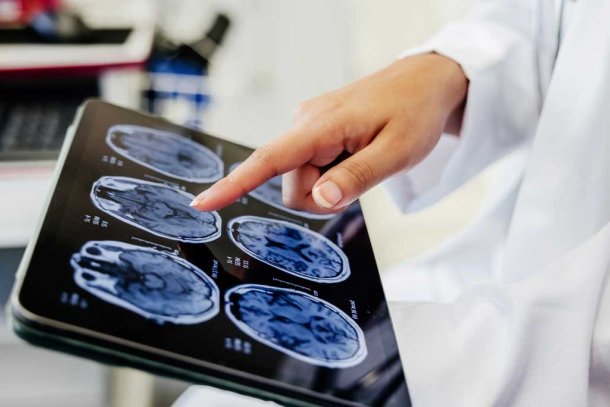 Hersenscan op tablet