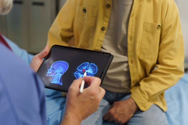 Arts bekijkt Alzheimersscans